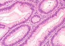 조직학 - 그것은 무엇입니까, 개념, 정의, 유형